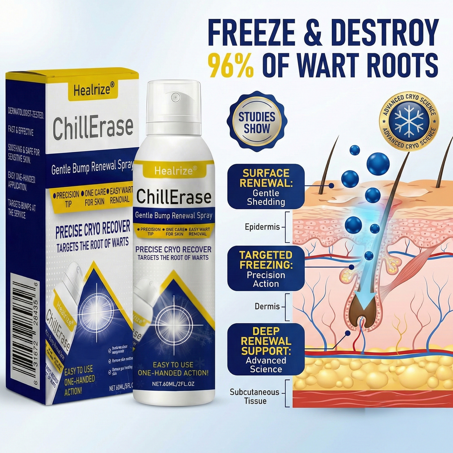 ❄️Healrize®ChillErase Gentle Bump Renewal Spray—✨Stubborn Skin Bumps & Rough Spots