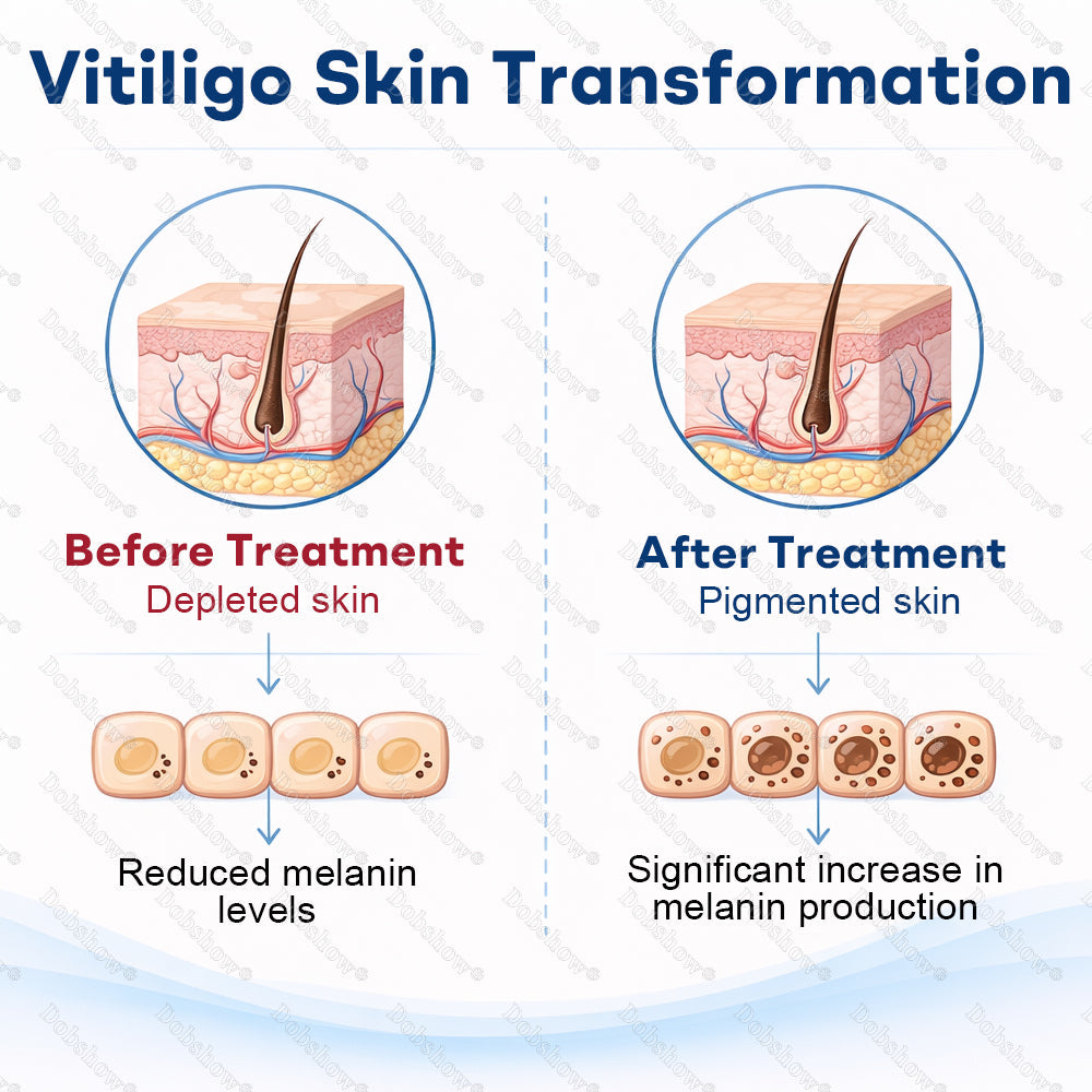 👨‍⚕️🔥Healrize® Piperine Vitiligo Repigmentation Spray - 🌿Steroid-Free Botanical Formula | Gentle & Effective for All Skin Types