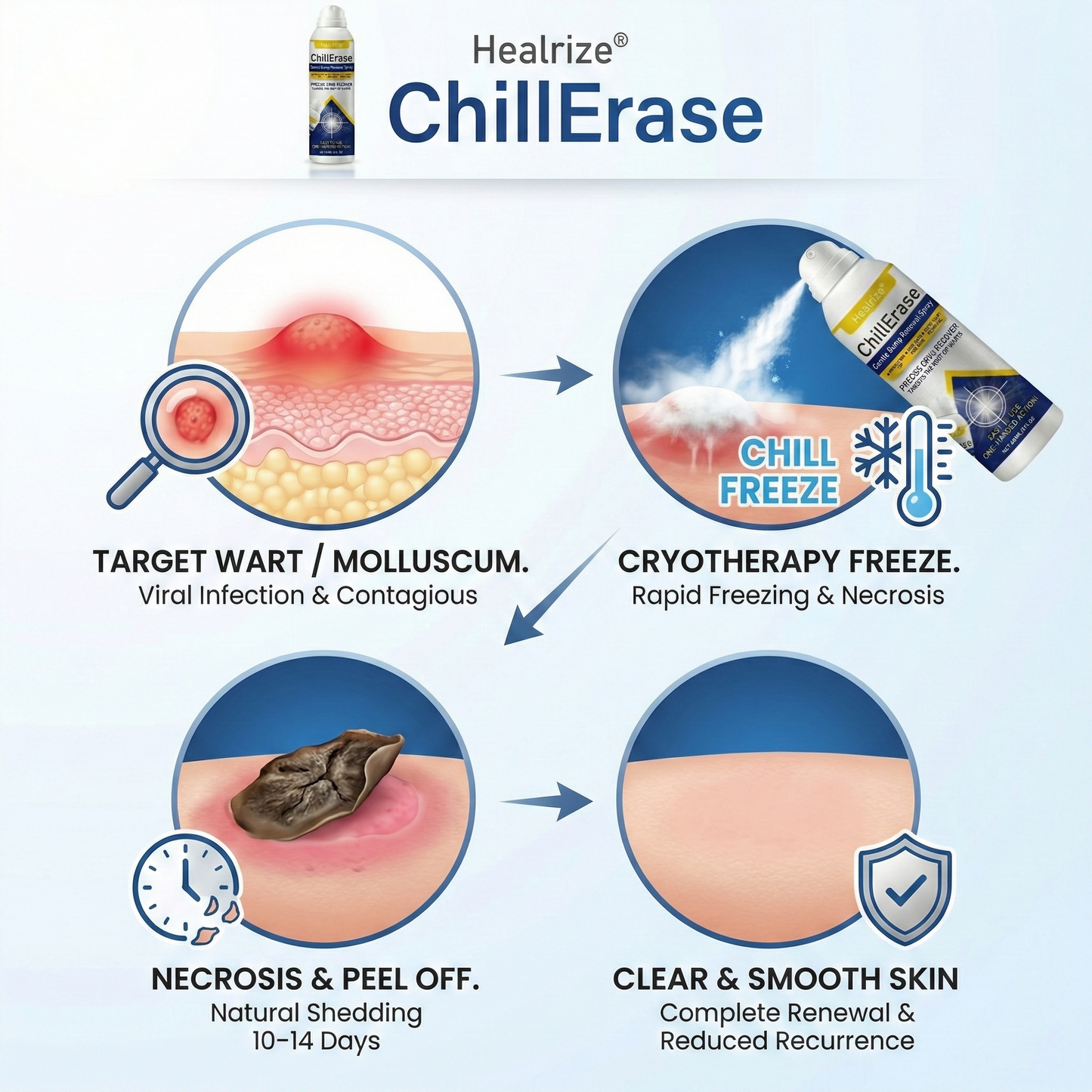 ❄️Healrize®ChillErase Gentle Bump Renewal Spray—✨Stubborn Skin Bumps & Rough Spots