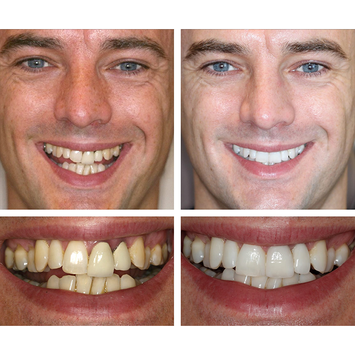 Smile Glow Essence