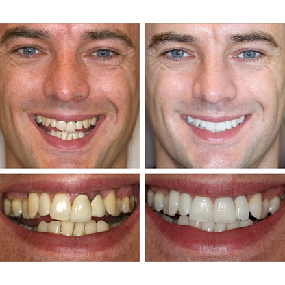 Smile Glow Essence