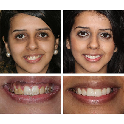Smile Glow Essence