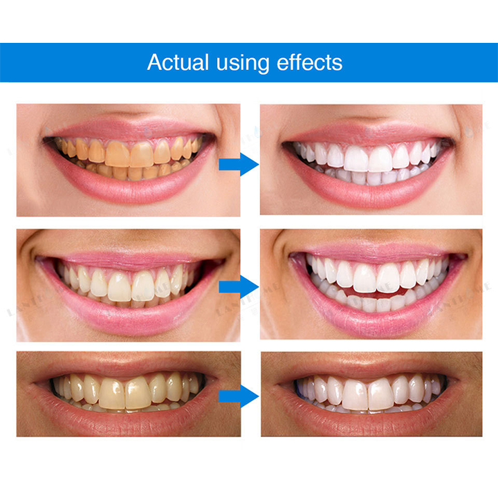 Smile Glow Essence